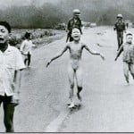 Kim Phuc com 09 anos - Bombardeio com Napalm