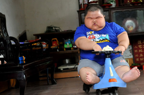 Garoto chinês de 3 anos pesa 60 kg Garoto chinês de 3 anos pesa 60 kg