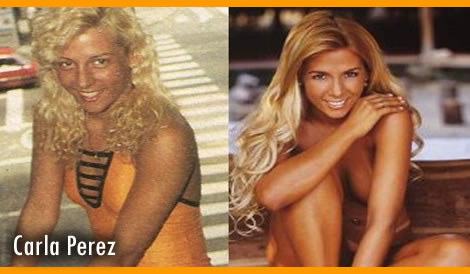 Fotos de famosos antes e depois da fama