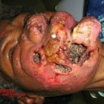 Calcanhar de Maracujá: O que é? Imagens e vídeos