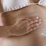 Dicas para evitar estrias na gravidez