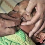 A estranha raspagem dos olhos na China