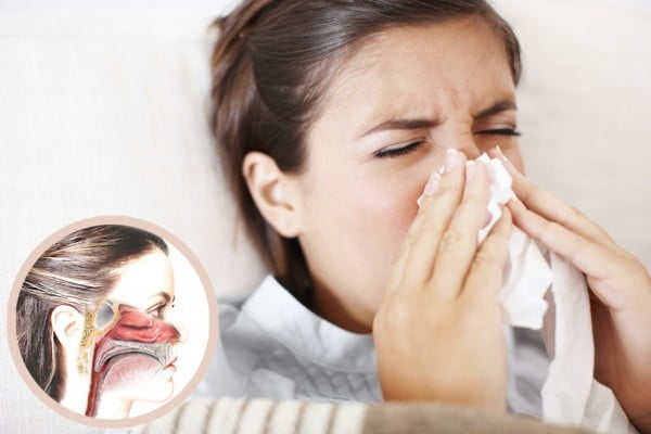 aliviar alergias